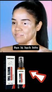 HOÀN TIỀN 15% - Loại Bỏ Bạch Biến South Moon Xịt Làm Sạch Bạch Biến Xóa Sạch Đốm Trắng Trên Da Đánh Bay nấm Ngứa Lang Ben Hắc Lào Chăm Sóc Da Mặt Làm Giảm Các Đốm Trắng Trên Da Làm Đều Màu Da Điều Chỉnh Sắc Tố Chăm Sóc Sức Khỏe Da - Lazada