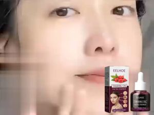 EELHOE 20ml Minyak Esensial Wajah: Solusi Kulit Sensitif & Jerawat