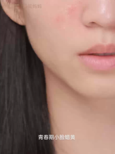 Kangaroo Mommy Teenager Brightening & Moisturizing Skincare Age 9 -18 青少年水润透亮护肤品