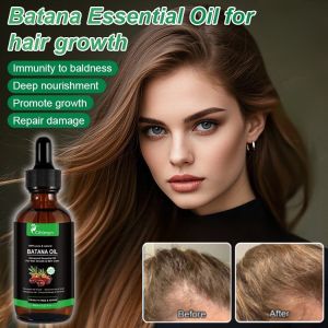 Batana Essential Oil For Hair Growth Anti Hair Loss Nourishing Thicken Repair Damaged Dryness Frizz Hair Care