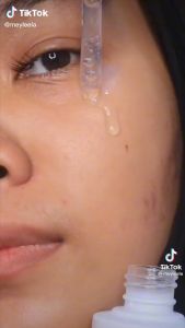 YOU RADIANCE UP ANTIOXIDANT SERUM 20ML I Niacinamide Vitamin C Atasi Bekas Jerawat & Dark Spot Tender Care