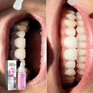 oralhoe | Teeth Whitening Essence Eliminate Bad Odor Freshing Breath Remove Dental Plaque Stains Reduce Bleeding Oral Care Gum Protection