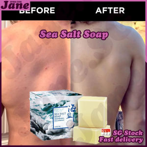 🎈𝙎𝙂 𝙎𝙩𝙤𝙘𝙠🎈 Sea salt soap / Removal pimple pores blackhead / Anti acne soap moisturizing / Goat milk face wash soap / 海盐皂 / 除螨皂