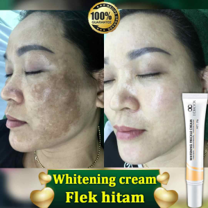Whitening Freckle Remover Cream Nicotinamide Brightens Skin Anti freckle whitening cream Krim jeragat dark spots remover cream LYDIMOON 20g 烟酰胺 美白祛斑霜