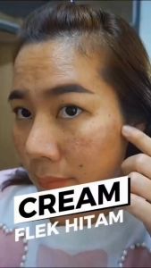 Cream Ori Queenza Glow: Solusi Flek Jerawat & Kulit Kusam