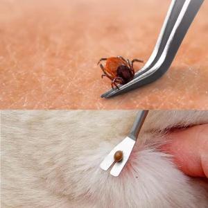 2 in 1 Tick Remover Tool Professional Removal Tweezers for Humans & Pets Pets Flea and Tick Removal Remover Tools