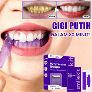 SmileKit V34 Whitening Strips Purple Remove Teeth Stains Suitable For Sensitive Gums Visible Results in 7 Days 美白牙贴