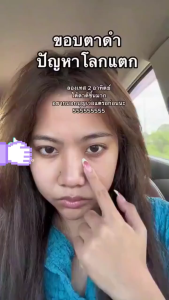 5D เรตินอลอายครีม ครีมทาใต้ตา ครีมใต้ตา 120g ริ้วรอย ลดถุงน้ำใต้ตา รอยคล้ำใต้ตา ริ้วรอยตีนกา ให้ความชุ่มชื้น