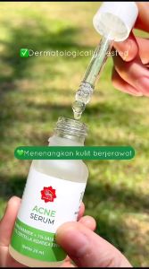 Viva Acne Serum - Serum untuk perawatan wajah berjerawat