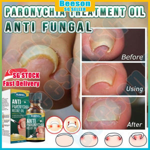 ⭐️𝒔𝒈 𝒔𝒕𝒐𝒄𝒌⭐️ Nail fungus treatment liquid / Nail repair serum / Anti paronychia relief oil / Ingrown toenail treatment 甲沟炎