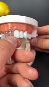 3.000 BUTIR Temptooth Tambal Gigi Permanen Authentic