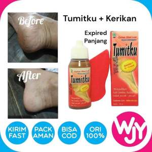 TUMITKU 30ML KAKI PECAH obat ampuh untuk menghilangkan kulit mati / KAPALAN DI KAKI