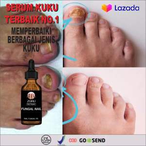 TERLARIS!! Repair serum Penumbuh kuku penghilang jamur kuku dan centengan AMPUH 100% ORIGINAL