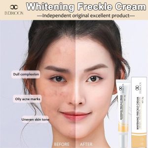 Whitening freckle remover cream 20g anti freckle whitening cream Krim jeragat dark spots remover cream Moisturizing remove chloasma and melanin