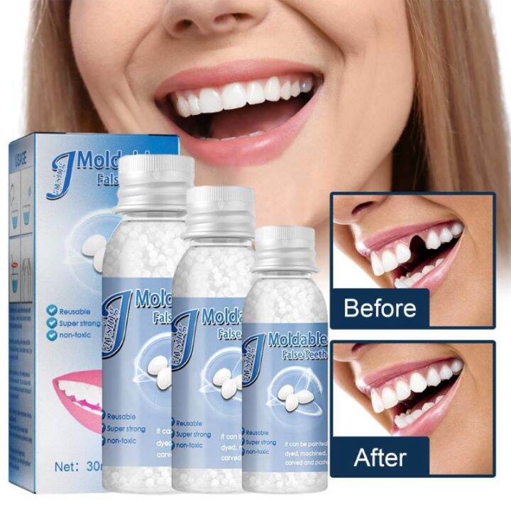 【Fast filling】teeth temporary tooth repair kit teeth restoration ...