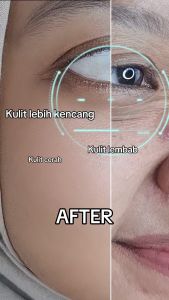 𝐋𝐚𝐥𝐨𝐭𝐮𝐬𝐤𝐢𝐧 Clearskin Treatment Serum With DNA Salmon Dan Retinol