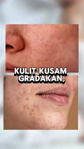 SABUN ETAWA SUSU Plus Colagen Sabun Mencerahkan Melembapkan dan Melembutkan Kulit - 60 GR