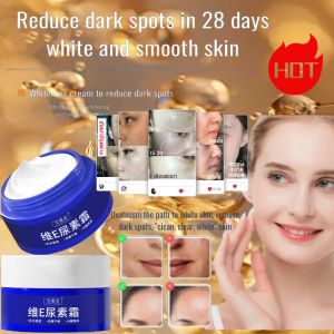 Spot Fading Urea Cream Moisturizing Hydrating Anti-Age Vitamin E Face Cream Melasma Freckle Reduce Dark Spots Face Skin Care 淡斑尿素霜