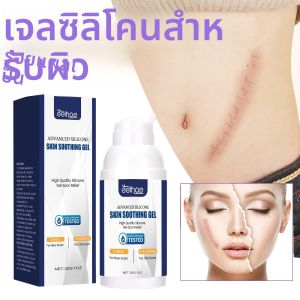 EELHOE เจลซิลิโคนผิวรอยแผลเป็นเรตินอล ไนอาซินาไมด์รอยแผลเป็นรอยแตกลายรอยไหม้ลึกบำรุงผิวลดรอยแดงบวม 30g