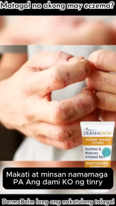 DermaBalm ECZEMA RASHES ITCHING Cream - 50g | Moisturizing Formula Soothes & Relieves Irritated Skin