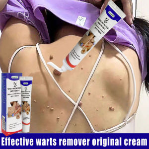 Natural Wart Removal Ointment Skin Care Products Moles and Warts Treatment Cream 20g Wart Cream Skin Tags Remover