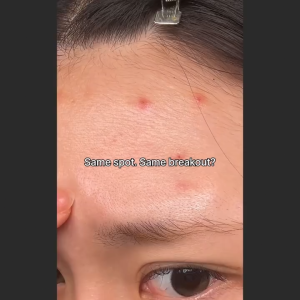 【SG Local SELLER】ARENCIA Eraser Booster Shot 30ml for AHA BHA Acne&Trouble Care