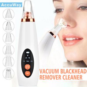 AccuWay Electric Skin Cleanser: A Comprehensive Guide to Blackhead Removal