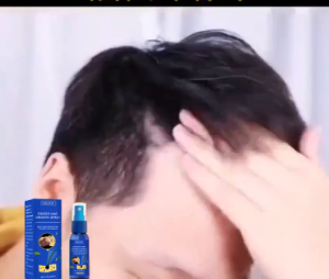 KADAIE EELHOE Spray Penumbuh Rambut Cepat - Obat Kebotakan Pria BPOM Anti Rontok Parah & Regenerasi Folikel