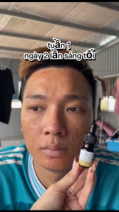 SERUM MỤN DR SKINBEAUTY XÓA MỤN THÂM SE LỖ CHÂN LÔNG GIÚP DA CĂNG BÓNG