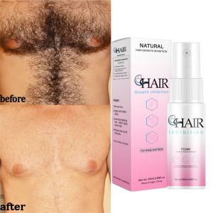 2 Minutes Fast Hair Removal Spray Painless Hair Growth Inhibitor Arm Armpit Leg Permanent Depilatory for Men Women Repair Care