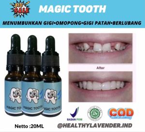 PENUMBUH GIGI LANGSUNG TUMBUH | GIGI OMPONGPATAH KEROPOS PEMUTIH GIGI DAN PENGHILANG KARANG GIGI ALAMI CEPAT DAN PERMANEN HALALBPOM ASLI 100% AMPUH [MAGIC TOOTH] |