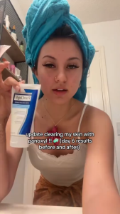 PanOxyl Benzoyl Peroxide Acne Foaming Wash  Facial Cleanser 4% 6 oz 170g（Old version）Gentle on sensitive. acne-prone skin