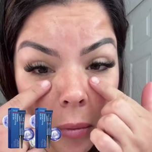 Hoygi | Hoygi Awaken Peptide Lifting Eye Gel Reduce Puffiness Dark Circles Deep Nourishing Rejuvenated Skin Daily Care Eye Lifting Gel