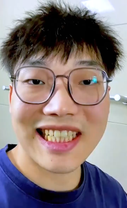 Teeth Whitening Toothpaste 150g Probiotic Toothpaste Fresh Breath Remove Tooth Stains Yellow Tooth Fresh Breath Care Gum Prevent Caries Repair Damaged Gums tartar tooth decay gum pain