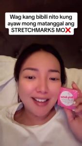 ROSMAR BELLY BUTTER 50G [FOR STRETCHMARK & SCARS]