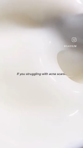 Glad2Glow Yuja Symwhite 377 Dark Spot Moisturizer (30ml) Contains aloe vera formula brightens skin tone