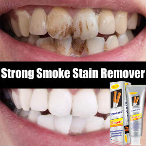 Pasta Gigi Pemutih & Penghilang Karang Gigi: Solusi Menghilangkan Noda Asap Merokok