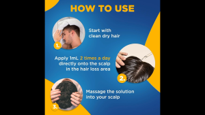 MINOXIDIL 5% FREE DROPPER NO LCLT