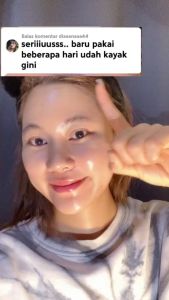 PHYLLIA - Sabun Pencerah Wajah Kulit Kusam Dan Penghilang Flek Hitam BPOM