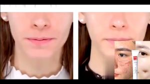 Krim penghilang flek hitam Krim Dark spot removal cream 20g Niacinamide Whitening Cream Serum Pemutih Wajah All Skin Types - Lazada