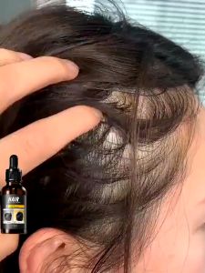 Hair Growth essence 30ml Promote hair growth Pure natural ingredients help hair regeneration and solve scalp pruritus