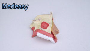 Training teaching model - Nasal cavity model