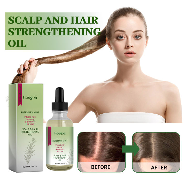 Thumbnail for Rosemary Hair Oil For Androgenetic Alopecia