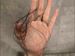 【RAVINIA】Hair Growth Spray-Promote Hair Growth-Prevent Hair Loss-Nourish&Strengthen Hair-防脱育发生发喷雾<<Ready Stock>>