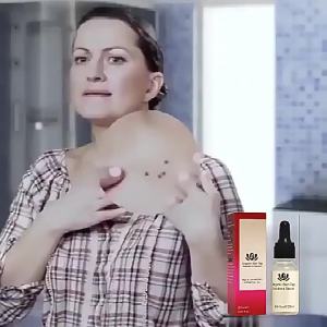 Penghilang Tahi Lalat & Kutil: Wart Remover Wajah 💖Uiabgt