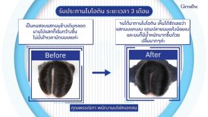 กิฟฟารีน ไบโอติน เอช พลัส ขนาด 30 แคปซูล ผมร่วง วิตามิน ผมร่วงรุนแรง สำหรับผมบาง ผมร่วงหนักมาก ผมร่วงผมบาง ผมร่วง ยาบำรุง หัวล้าน