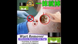 Eye Removal Wart Gel Warts cream eye warts essence ointment 20g Warts Skin Tag cream to hard skin wart Corn Warts calluses foot Corns Meat Thorn Antibacterial