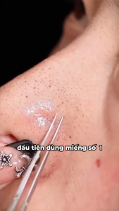 Miếng Dán Đẩy Nhân Mụn Khử Mụn Cám Đầu Đen HUNMUI – Dán Mũi HUNMUI Làm Sạch Mụn Cám Giảm Bóng Dầu Khử Thâm