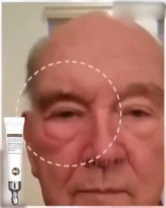 Dark Under Eye Care: A Comprehensive Guide