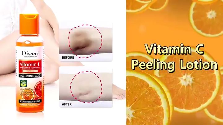 VC Peeling Lotion Whitening Smooth Skin Anti Wrinkle Orange Micropeeling Rejuvenating Skincare 100ml